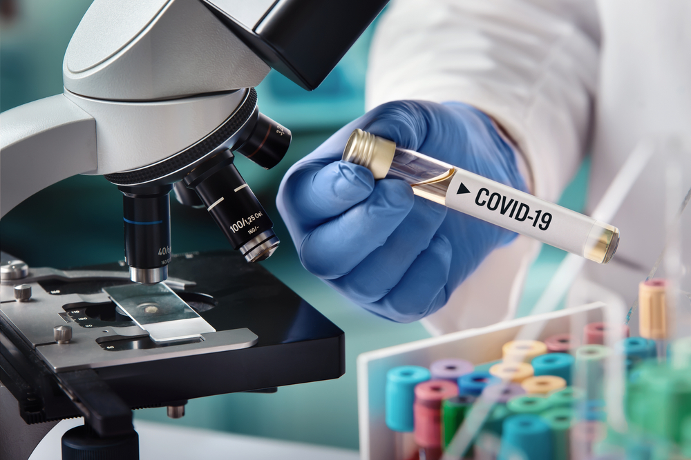 You are currently viewing Covid-19 علماء أتراك يطورون نظام يكتشف فيروس كورونا في ثوانٍ 2021